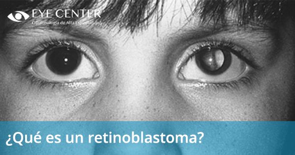 ¿Qué es un retinoblastoma?